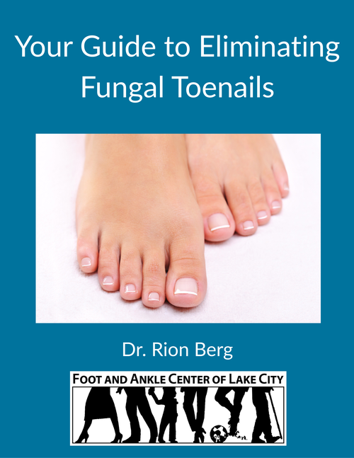 Guide To Eliminating Fungal Toenails in Seattle