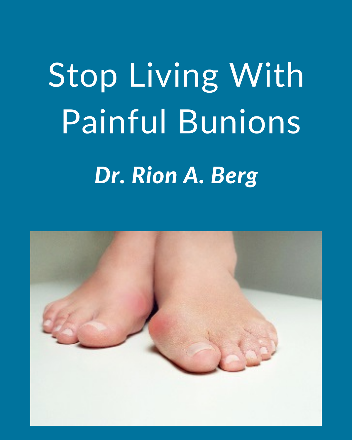 Stop Living With Painful Bunions in Seattle