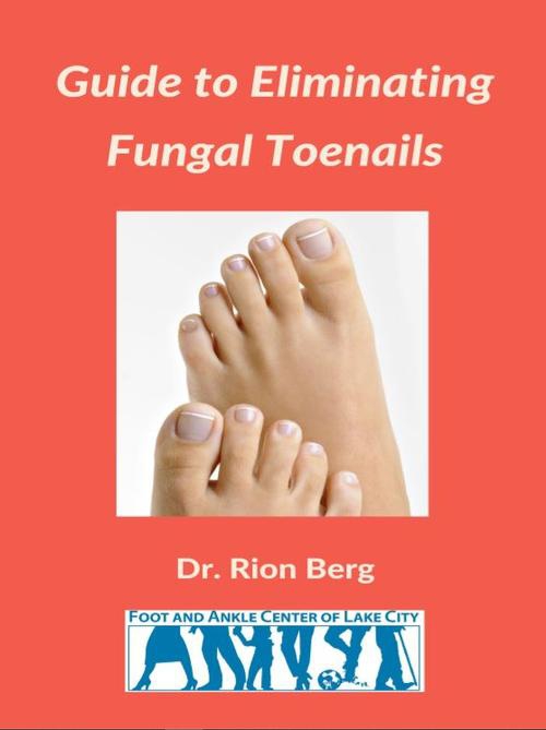 Guide To Eliminating Fungal Toenails